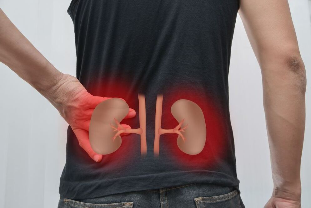 kidney inflammation as a cause of back pain