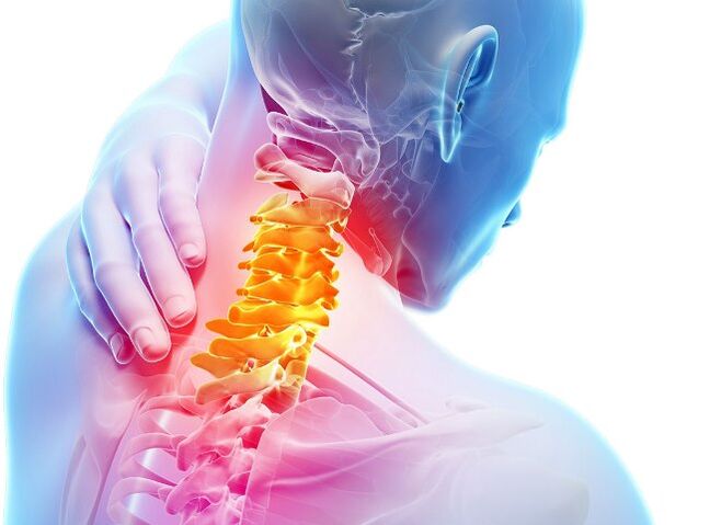 Symptoms and stages of development of cervical osteochondrosis