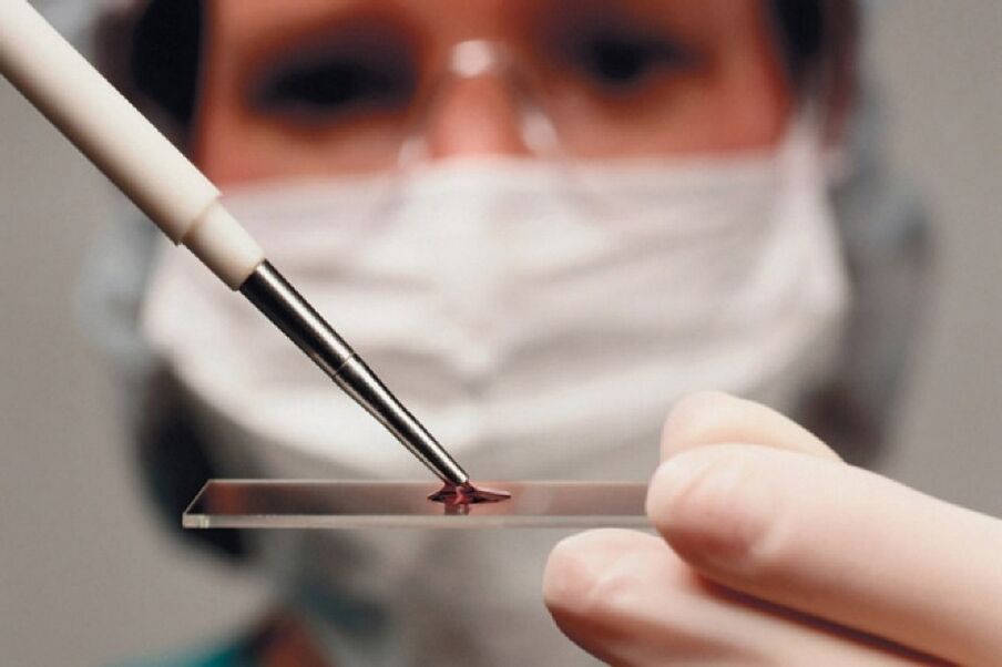 Arthritis is an inflammatory disease and its presence is detected by blood tests.